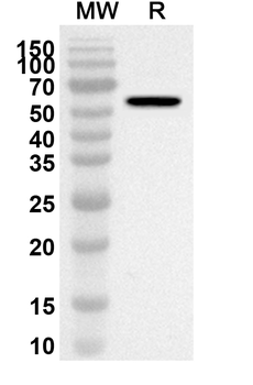 CCT3 Rabbit Polyclonal Antibody