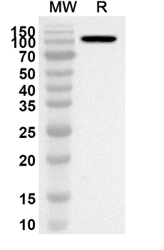 MDA5/IFIH1 Rabbit Polyclonal Antibody