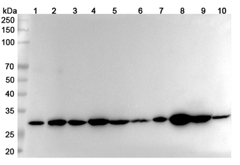 VAPB Rabbit Polyclonal Antibody