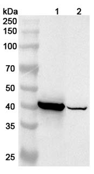 TNNT2 Rabbit Polyclonal Antibody