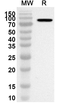 IFIT2 Rabbit Polyclonal Antibody