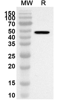UQCRC2 Rabbit Polyclonal Antibody