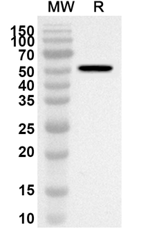 ATP5F1B Rabbit Polyclonal Antibody