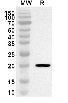 GORASP2 Rabbit Polyclonal Antibody
