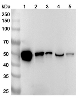 HNRNPH1 Rabbit Polyclonal Antibody