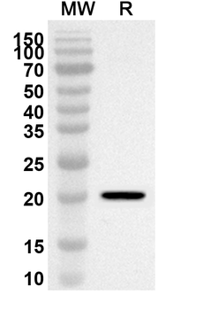 Lassa virus/LASV GPC Rabbit Polyclonal Antibody