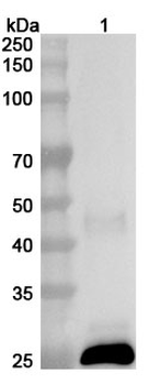 Lassa virus/LASV GPC Rabbit Polyclonal Antibody
