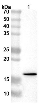 Hepatitis E virus genotype 1/HEV-1 ORF2 Rabbit Polyclonal Antibody