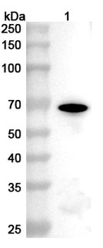Hepatitis E virus genotype 1/HEV-1 ORF2 Rabbit Polyclonal Antibody
