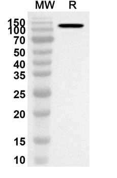 LAMC2 Rabbit Polyclonal Antibody