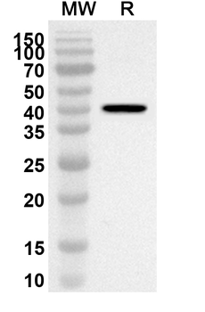 SLC34A2/ NaPi2b Rabbit Polyclonal Antibody