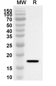 HPV52 E7/Protein E7 Rabbit Polyclonal Antibody