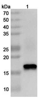 HPV52 E7/Protein E7 Rabbit Polyclonal Antibody