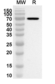 Palivizumab Rabbit Polyclonal Antibody