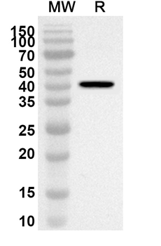 NSUN2 Rabbit Polyclonal Antibody