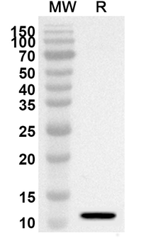 TGFBR1 Rabbit Polyclonal Antibody