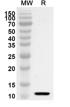 IL8/CXCL8 Rabbit Polyclonal Antibody