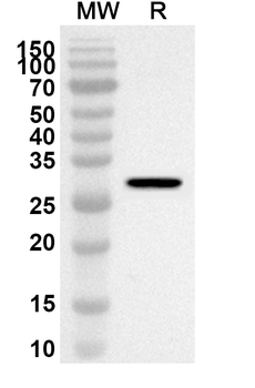 YTHDC/101267743 Rabbit Polyclonal Antibody