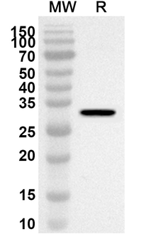 SPIN1 Rabbit Polyclonal Antibody