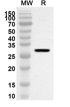 MTUS1 Rabbit Polyclonal Antibody