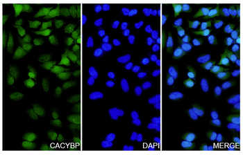 CACYBP Rabbit Polyclonal Antibody
