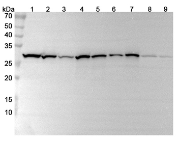 CACYBP Rabbit Polyclonal Antibody