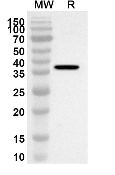 UCN2 Rabbit Polyclonal Antibody