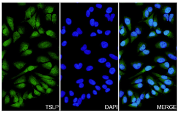 TSLP Rabbit Polyclonal Antibody