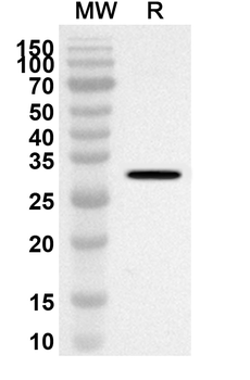 PLEC Rabbit Polyclonal Antibody