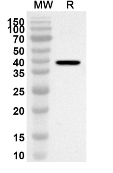 GAD2/GAD65 Rabbit Polyclonal Antibody
