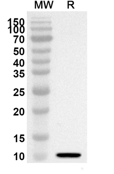 CCL7/MCP-3 Rabbit Polyclonal Antibody