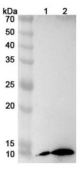 B2M Rabbit Polyclonal Antibody