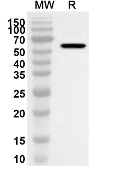 OXCT1 Rabbit Polyclonal Antibody