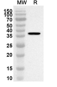 MAPK9 Rabbit Polyclonal Antibody