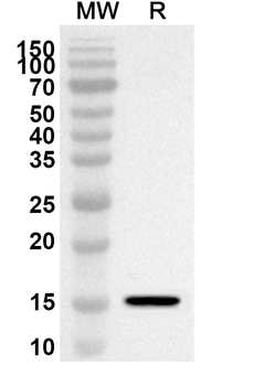 GLP1R Rabbit Polyclonal Antibody
