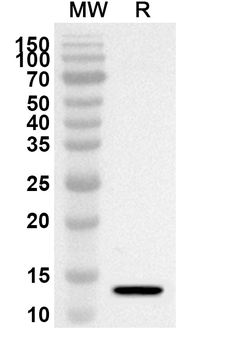 CD231/TSPAN7 Rabbit Polyclonal Antibody
