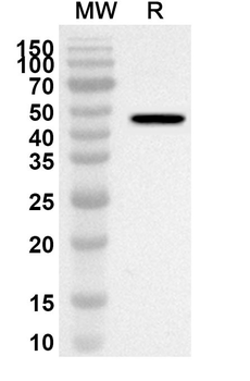 SRD5A2 Rabbit Polyclonal Antibody