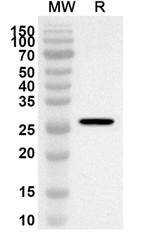 RPL10 Rabbit Polyclonal Antibody