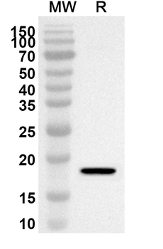 HK1 Rabbit Polyclonal Antibody