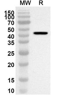 CD62E/SELE Rabbit Polyclonal Antibody