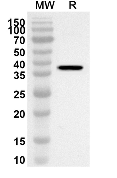 RBP3 Rabbit Polyclonal Antibody