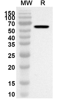 VIM/Vimentin Rabbit Polyclonal Antibody