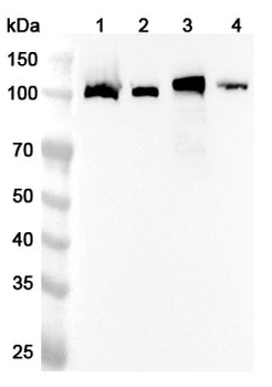 CD41/ITGA2B Rabbit Polyclonal Antibody