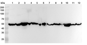 ENO1 Rabbit Polyclonal Antibody