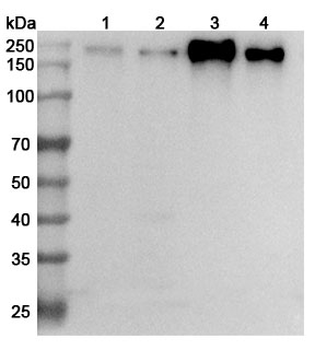 CD66e/CEA/CEACAM5 Rabbit Polyclonal Antibody