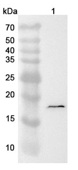 TTR Rabbit Polyclonal Antibody