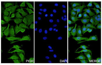 PIGR Rabbit Polyclonal Antibody