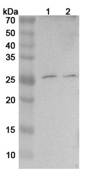 TNFa/TNF-alpha Rabbit Polyclonal Antibody