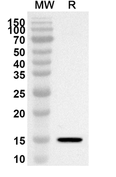 PDGFB Rabbit Polyclonal Antibody