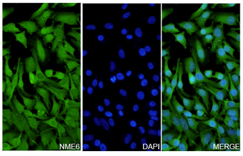 NME6 Rabbit Polyclonal Antibody